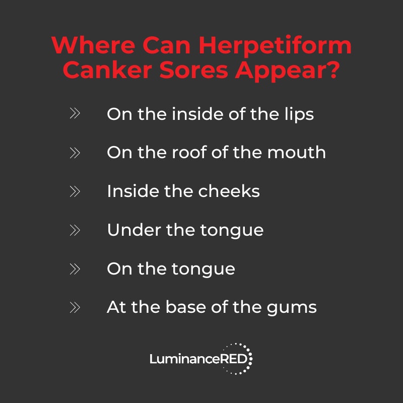 Infographic: Herpetiform Canker Sores: Everything You Need to Know